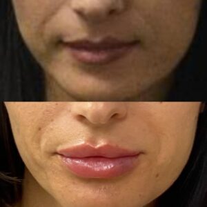 Wake Up Beautiful Spa Before and After