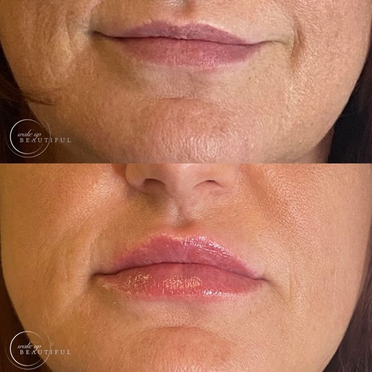 Wake Up Beautiful Spa Before and After