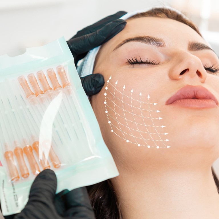 PDO Thread Lift Wake Up Beautiful Spa in Orange County CA