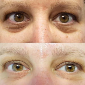 Wake Up Beautiful Spa before and After Aesthetic Results