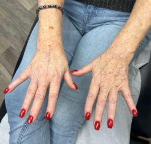 Wake Up Beautiful Spa before and After Aesthetic Results