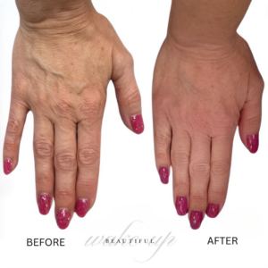 Wake Up Beautiful Spa hand treatment before and after