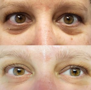 Wake Up Beautiful Spa before and After Aesthetic Results