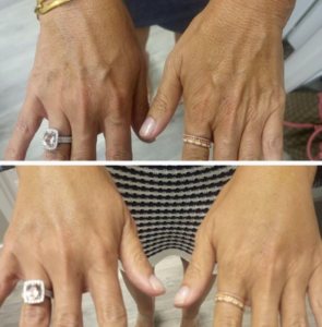 Wake Up Beautiful Spa before and after aesthetic results