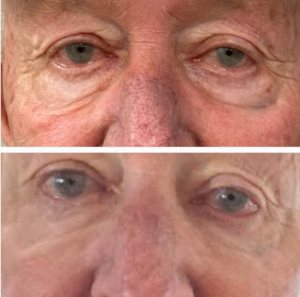 Wake Up Beautiful Spa before and after aesthetic results